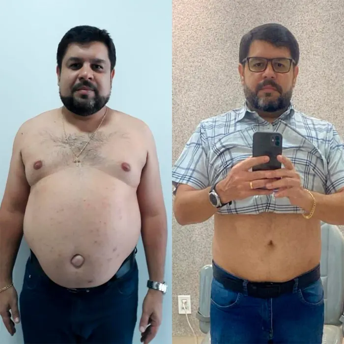 Resultado real 06 de acompanhamento médico individualizado