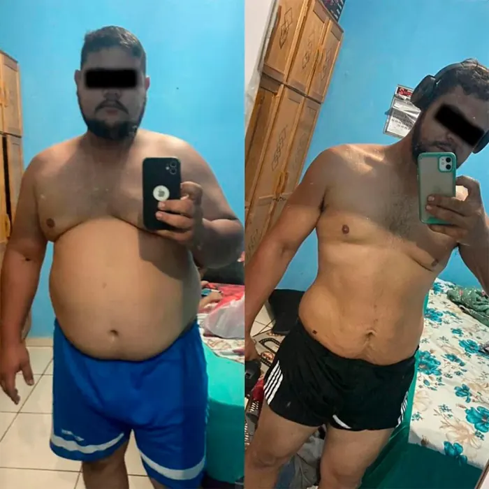 Resultado real 14 de acompanhamento médico individualizado